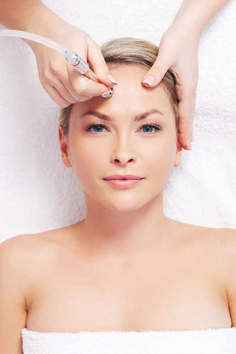 microdermabrasion treatment