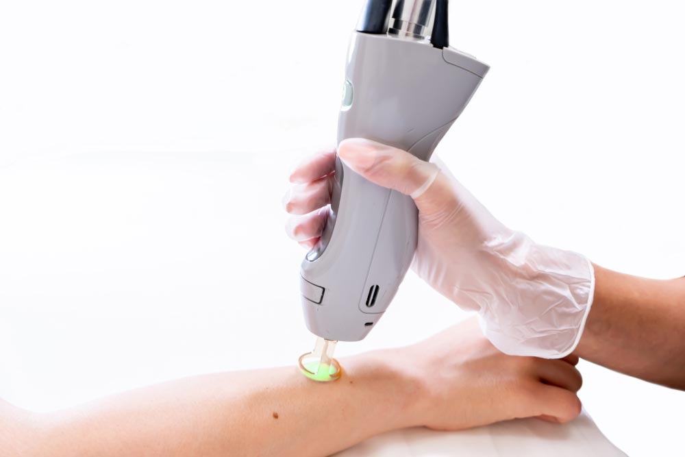 permanent-laser-hair-removal-mumbai-thane