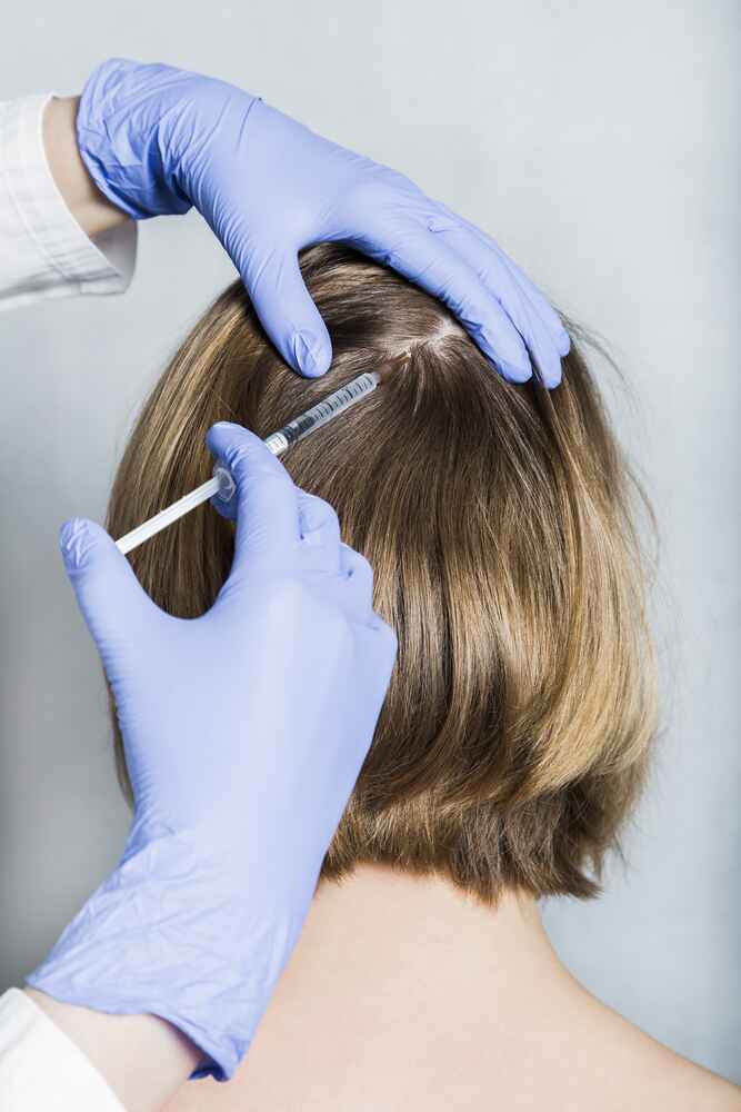 prp hair treatment